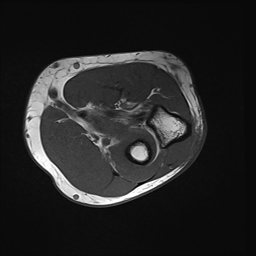 Click on the Serie image to view the images of Wieszt, Gnter